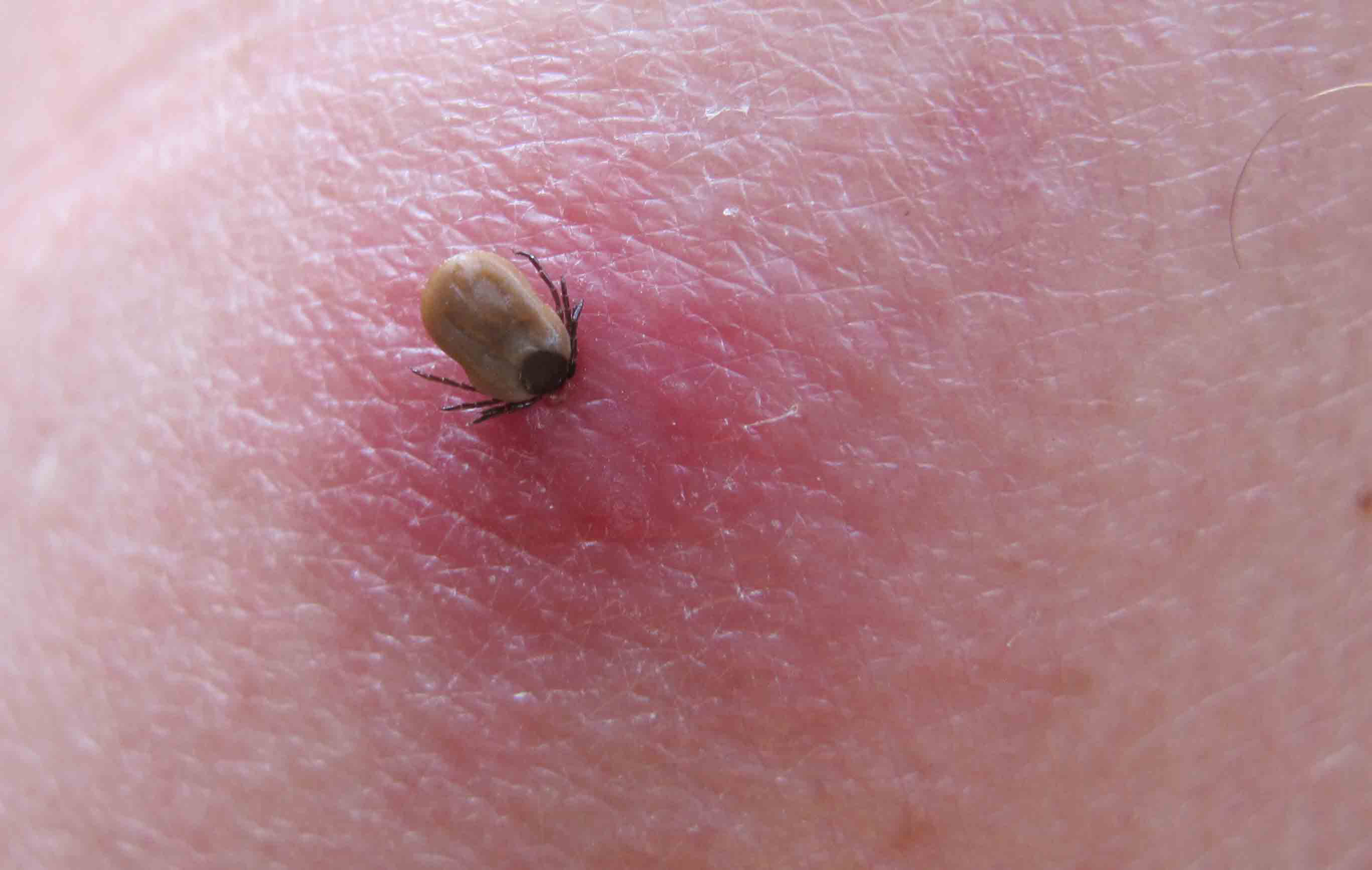 allergische reactie huid